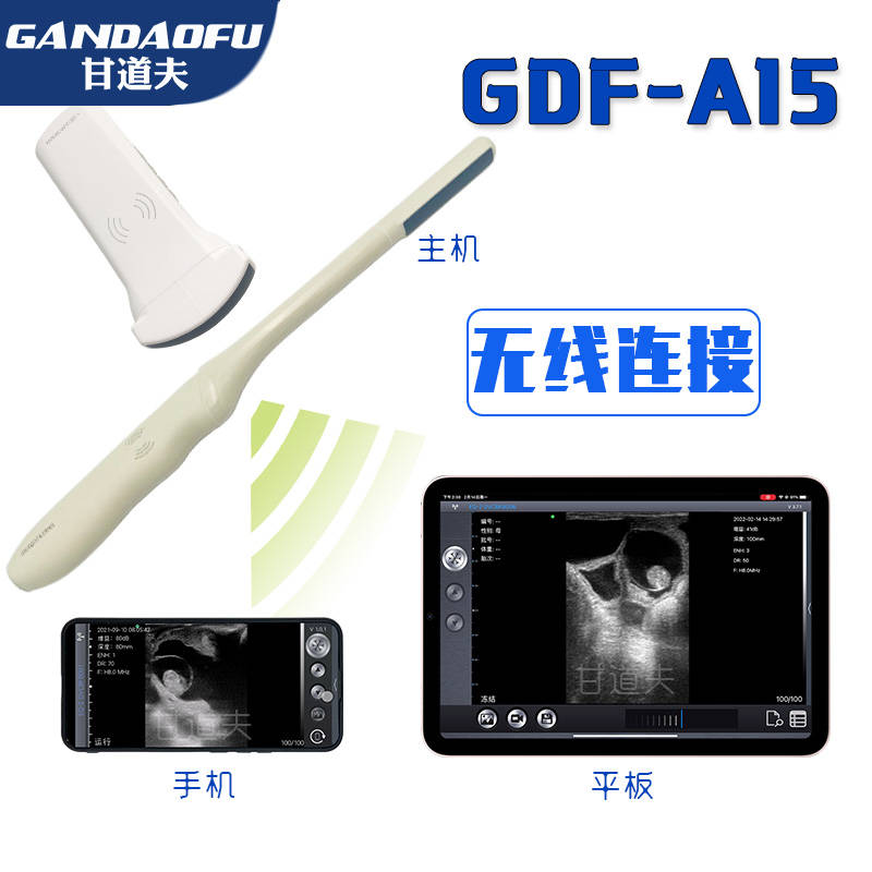 招标采购无线羊智能B超GDF-A15报价价格羊B超厂家品牌