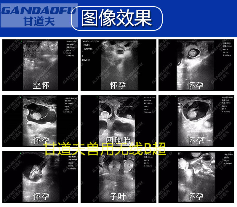 招标采购无线羊智能B超GDF-A15报价价格羊B超厂家品牌