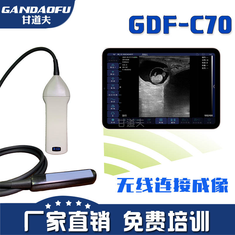 2025招标采购兽用无线B超价格牛羊用B超厂家新报价大全